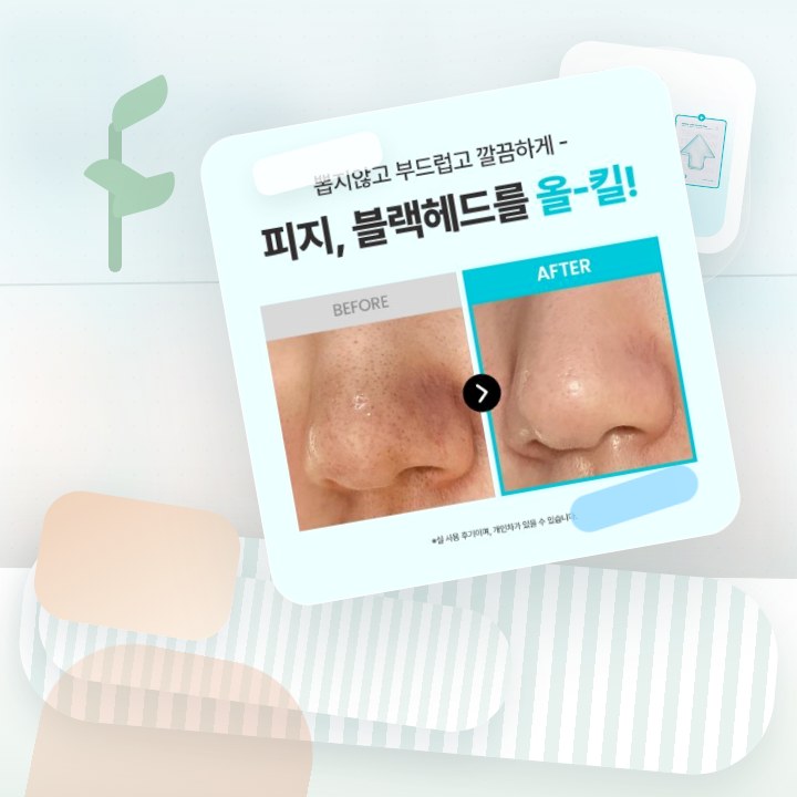 일소 슈퍼 멜팅 세범 소프트너 150g 기획 (+착붙솜40매… 후기형 사진 4